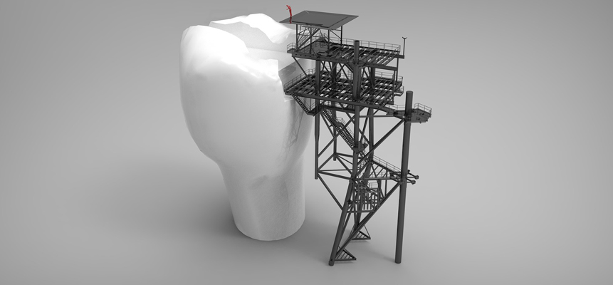 Prótese dentária